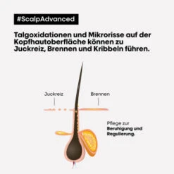 L'Oréal Professionnel Paris Serie Expert Scalp Advanced Anti-Discomfort Intense Soother Treatment 200 Ml -Modekosmetikgeschäft 2541947 L Oreal Professionnel Paris Serie Expert Scalp Advanced Anti Discomfort Intense Soother Tre.8322c156